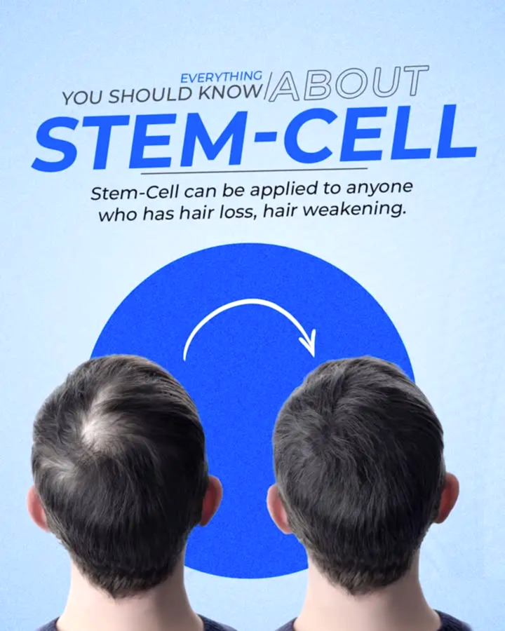 kök hücre saç tedavisi nedir